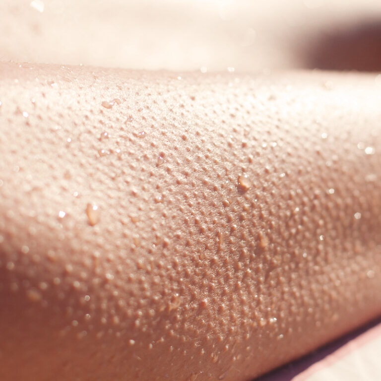 Woman’s legs with goosebumps