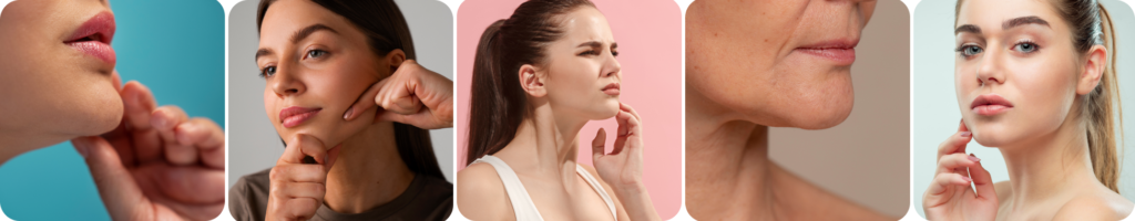 Double chin and facial contouring