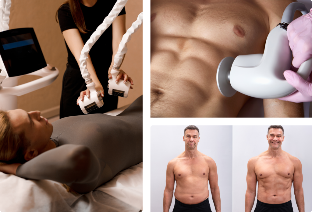 Male Hormone Replacement Therapy (BHRT)