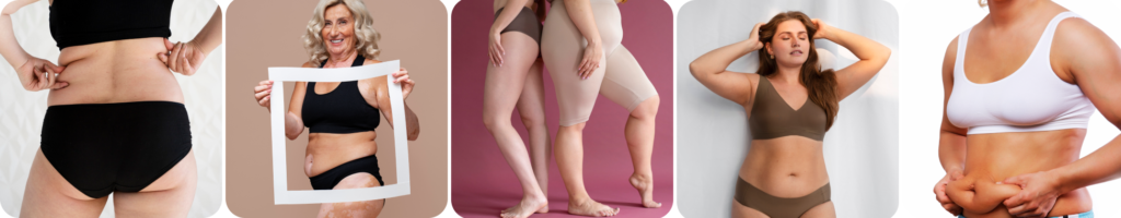 Unwanted Body Fat