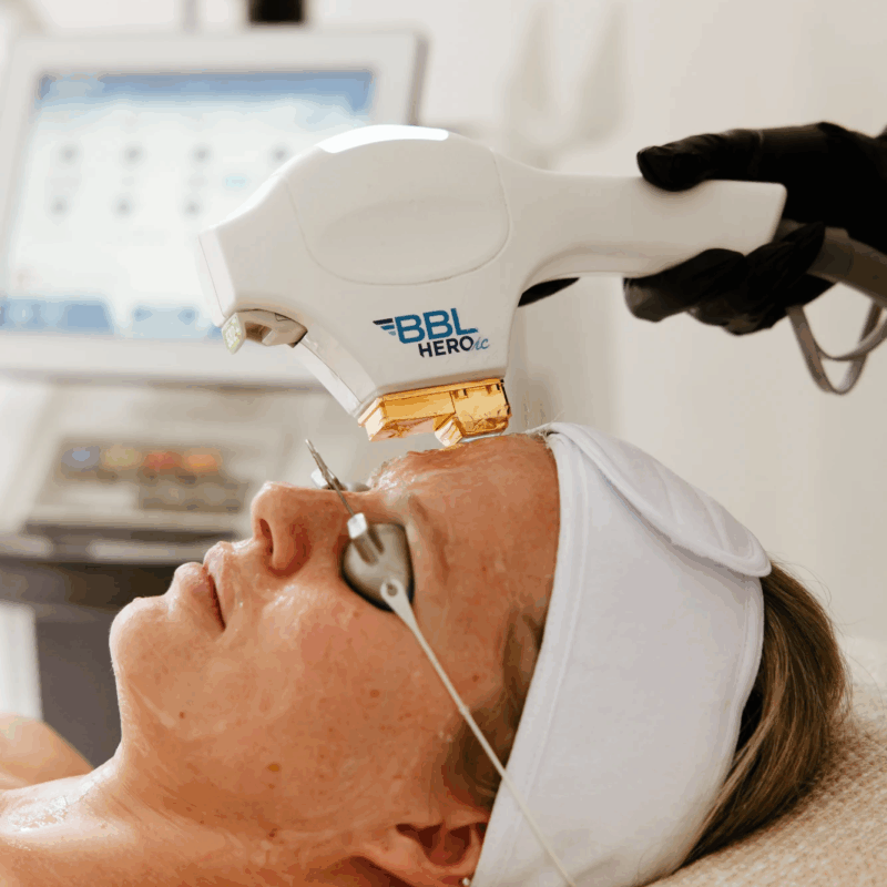 Sciton-BBL-HEROic (1)